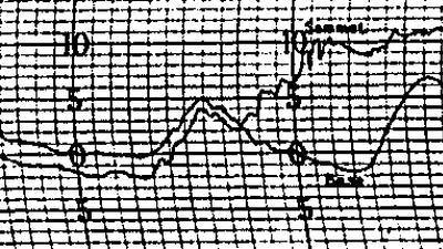 Observations meteo de la tour Eiffel de 1890 à 1894.php